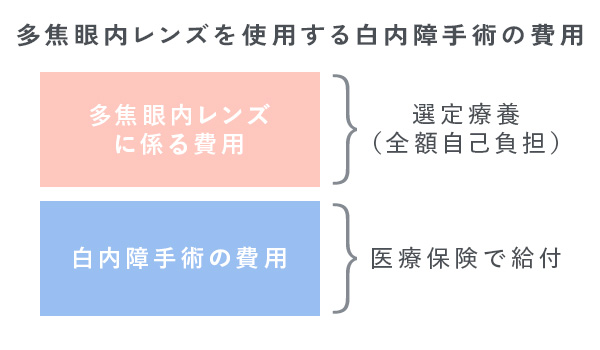 多焦眼内レンズを使用する白内障手術の費用のイメージ画像