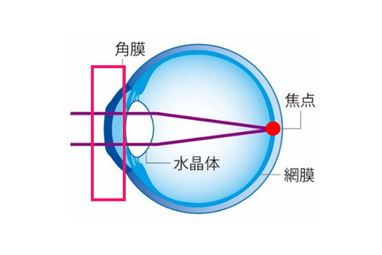昼：レンズをはずした後